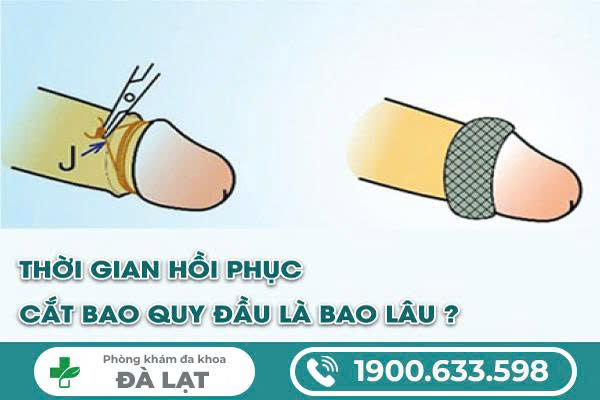 Hình ảnh minh họa